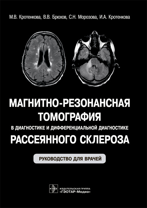Магнитно-резонансная томография в диагностике и дифференциальной диагностике рассеянного склероза. Руководство